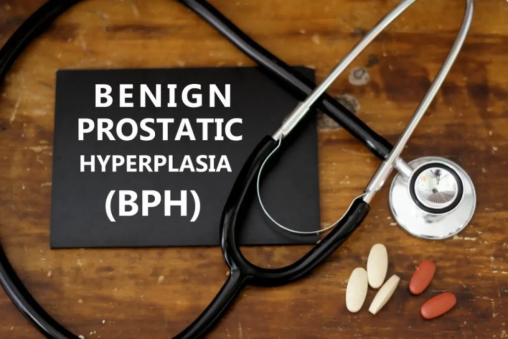 What is BPH and Its Symptoms