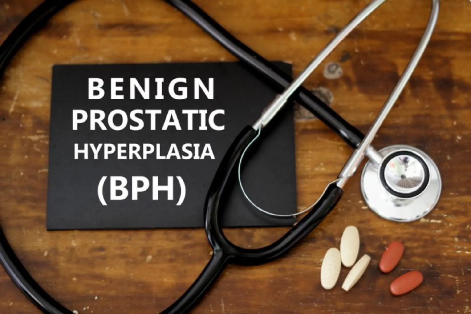 What is BPH and Its Symptoms?